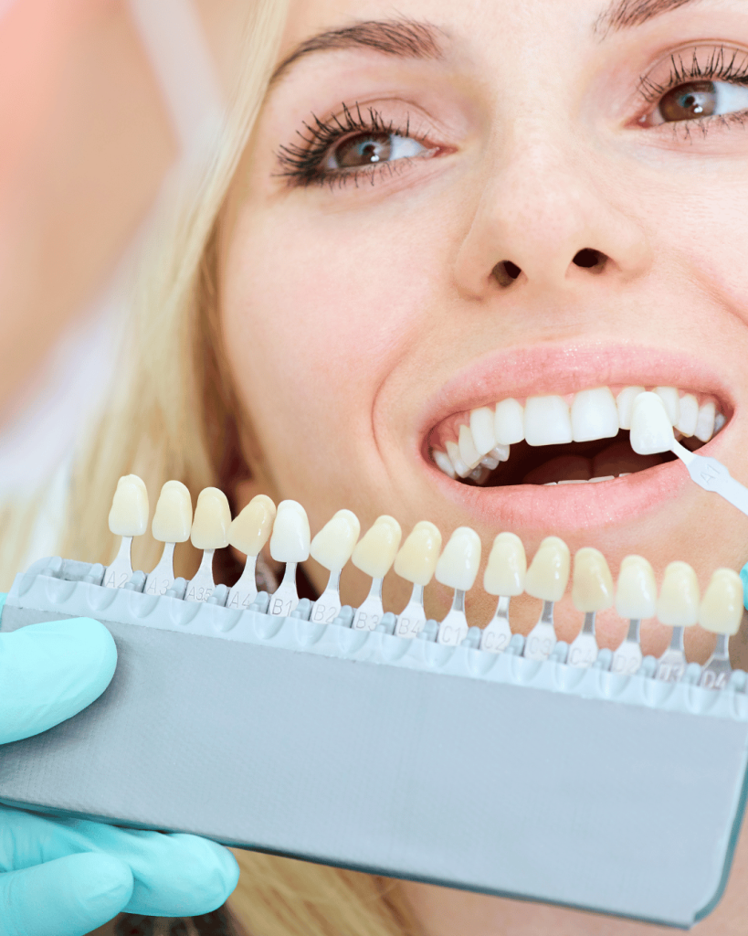 dental crowns Windsor treatment
