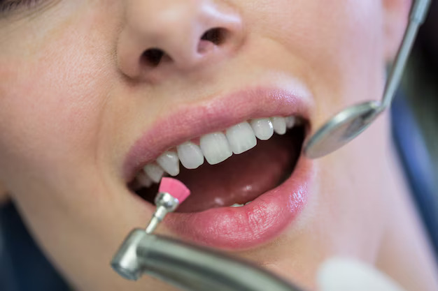 fluoride treatment being applied to teeth Windsor clinic
