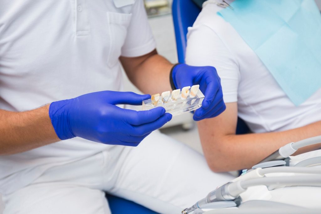 dental bridges Windsor procedure